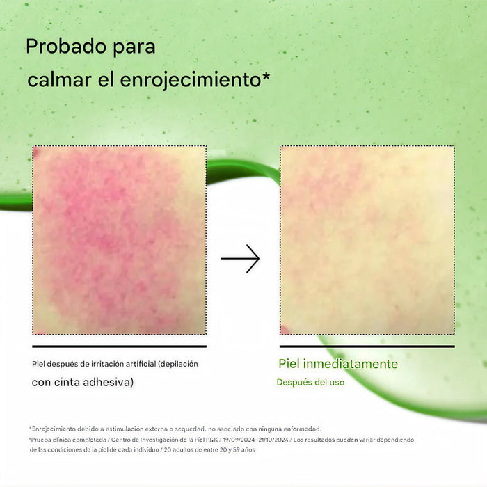 Azelaic Acid 10 Hyaluron Redness Soothing Serum 30ml