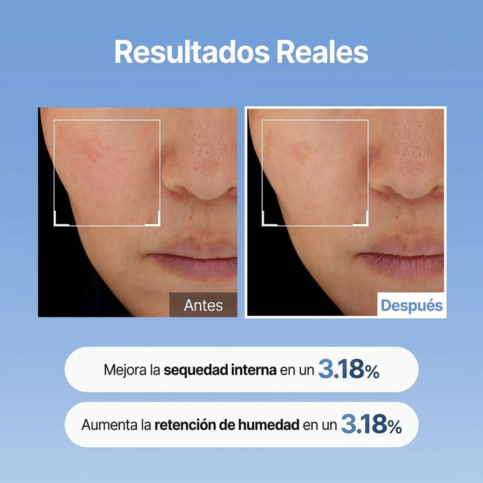 Hyaluronic Acid Skin Booster First Serum 150ml