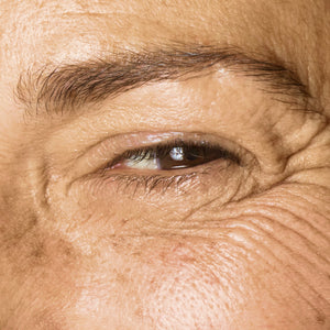 Anti-Age
